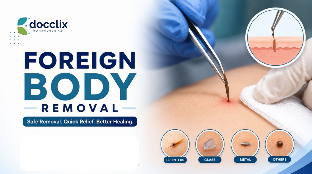 A Guide to Foreign Body Removal Treatment
