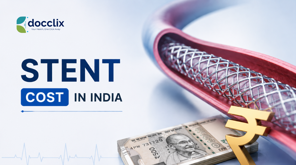 The Ultimate Guide to Stent Cost in India
