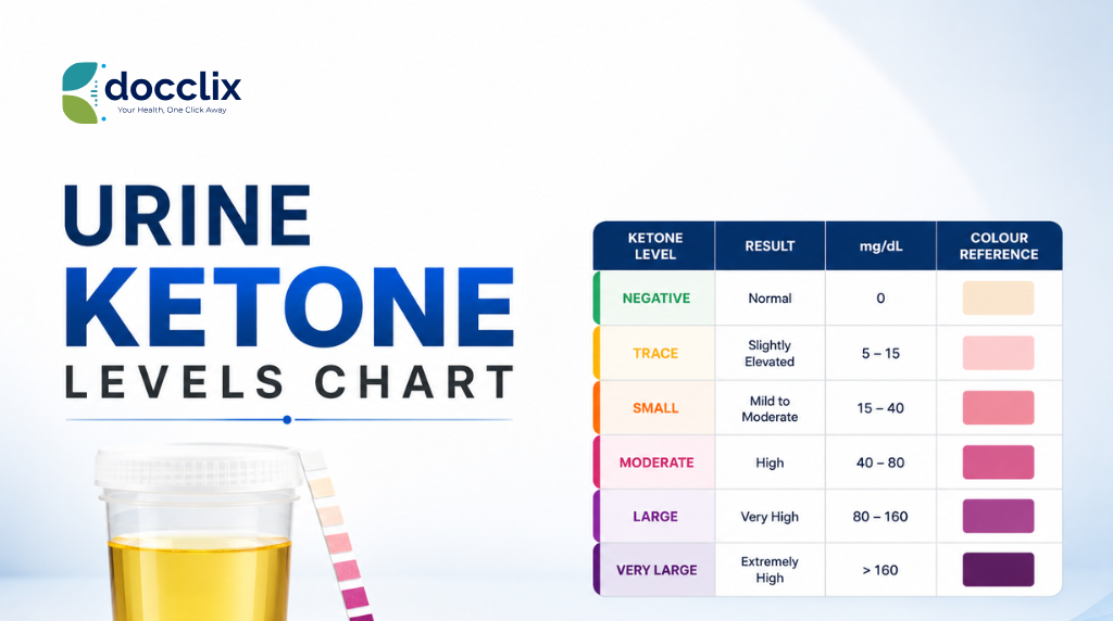 Urine Ketone Levels Chart: All You Need to Know