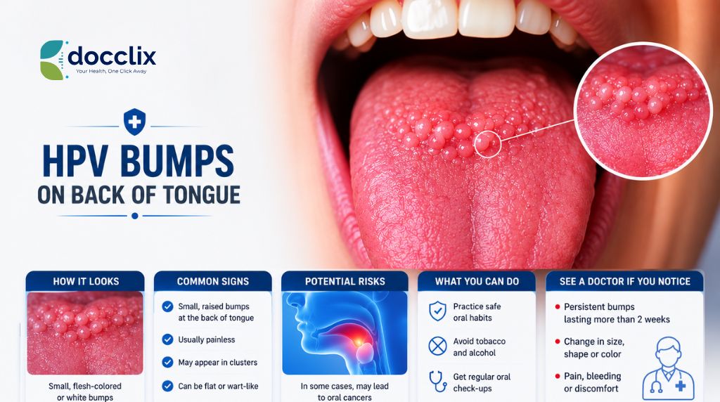 HPV Bumps on Back of Tongue: A Complete Guide
